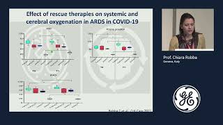 Advanced monitoring techniques  GE Healthcare Clinical Symposium  Euroanaesthesia 2022 [upl. by Akirahs191]