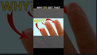 Why Do get that finger wrinkles 😱 viralshort knowledge amazingfacts shortsfeed [upl. by Yartnod]