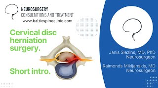 Cervical disc herniation Short intro to surgery setup and execution [upl. by Naginnarb]