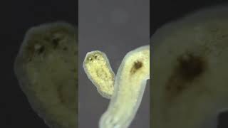 Planarian parasite flatworms under microscope [upl. by Akenal]