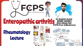 Enteropathic spondylo arthritis by Dr Raghib Asfak  সম্পূর্ণ বাংলায় [upl. by Nylkcaj]