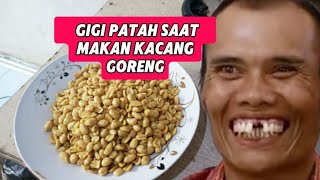 GIGI PATAH SAAT MAKAN KACANG GORENG [upl. by Arikehs]