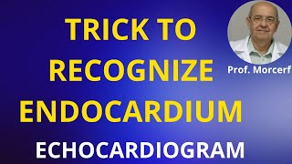 Trick to Avoid Pitfalls in Tracing LV Endocardium [upl. by Wade]