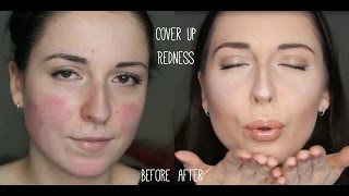 MakeUp Tutorial for Rosacea  Party Camouflage  Contouring Makeup [upl. by Sudnor]