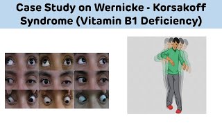 Case Study On Wernicke Korsakoff Syndrome Vitamin B1 Deficiency  Biochemistry Case Study [upl. by Annayak]