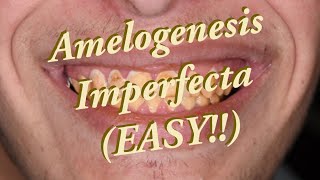 Amelogenesis Imperfecta SIMPLIFIED [upl. by Ioves]