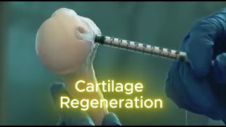 Revolutionary CARTILAGE Regeneration Tech Thats Changing Lives [upl. by Nereen]