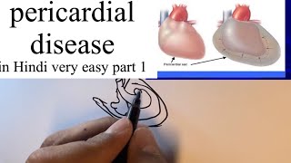 Pericardial disease pathology in hindi part 1 signsymptomsclinicaldiagnosis and treatment [upl. by Atinaj]