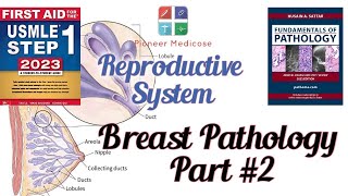 Breast pathologyCancer from Pathoma in urdu Part2 Reproductive system pathUrduHindi [upl. by Bianca872]