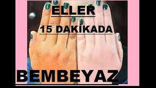 15 DAKİKADA GÜNEŞ LEKESİ  YAŞLILIK LEKESİ GİDERİCİ BEYAZLATICI  DOĞAL EL BAKIMI  Güzellik Bakım [upl. by Giffy]