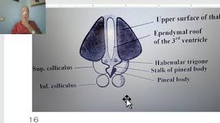 Anatomy of CNS Module in Arabic 2024 Epithalamus by Dr Wahdan [upl. by Nadirehs]