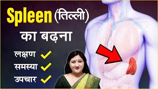 Spleen Enlargement Treatment  Spleen Large Size Treatment In Hindi  Enlarged Spleen Symptoms [upl. by Verner273]