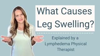 Causes of Leg Swelling Ankle Edema and Swollen Feet [upl. by Iror]