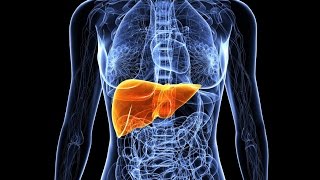 Primary Biliary Cirrhosis [upl. by Arerrac6]