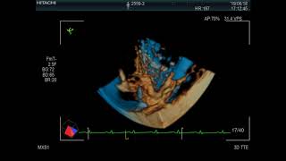 Urolithiasis in a cat  prior to catheterization by 3D4D echoultrasound （猫の尿石症 処置前3D4Dエコー） [upl. by Obidiah]