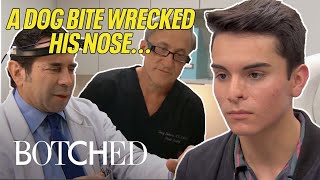 Dr Paul Nassif and Dr Terry Dubrows Most CHALLENGING Botched Surgeries  Botched  E [upl. by Limbert]