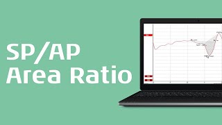 Using the SPAP Area Ratio for Diagnosis of Menieres Disease [upl. by Tikna]