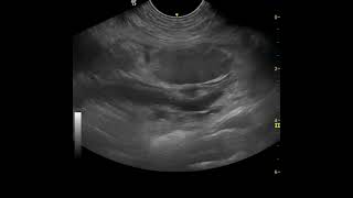 mesenteric torsion in a dog oedemahaemorrhage in the root of the mesentery [upl. by Cherian]