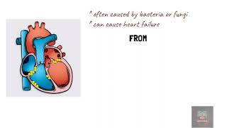 Infective endocarditis symptoms mnemonics [upl. by Keon]