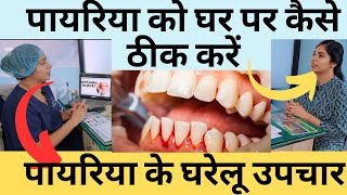 पायरिया का घरेलु इलाज  Pyorrhea Treatment At Home  Home Remedies For Periodontitis  pyorrhea [upl. by Rae]