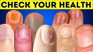 10 Things Your Nails Tell About Your Health [upl. by Uriel790]