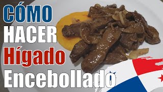 Hígado encebollado Panameño  Zu cocina [upl. by Drarig]