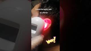 Cold laser therapy for tinnitus  Domer Laser review [upl. by Leinod]