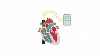 Assessing tricuspid valve stenosis [upl. by Blumenthal]