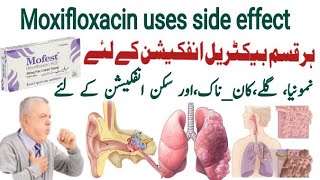 moxifloxacin 400 mg uses in urdu moxifloxacin 400 mg  Mofest 400mg  X gen 400mg  Avelox 400mg [upl. by Barcus193]