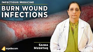 BurnWound Infections Diagnosis Internal Medicine Study Guide Lecture VLearning™ [upl. by Farrel200]