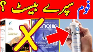 Rogaine Foam Spray 100 Result  How To Apply Monxidil Spray [upl. by Durning409]