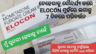 ମୁଁ ସୁନ୍ଦରୀ ହେବାକୁ ଚାହେଁ  Elocon  Mometasone Furoate Cream  ଚେହେରା ସୌନ୍ଦର୍ଯ୍ୟ ବଢ଼ାନ୍ତୁ 7ଦିନରେ [upl. by Giffard]