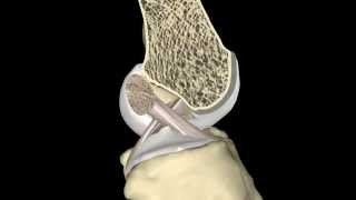 The ACL During Knee Range of Motion [upl. by Merth]