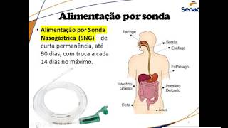 Sonda Alimentares [upl. by Ijneb]