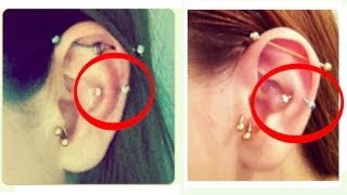 Piercings na Cartilagem Cuidando de uma inflamaçãoinfecção [upl. by Poucher44]