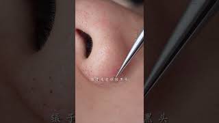 immersive skin care strawberry nose blackhead deep pore cleaning skin management [upl. by Steward]