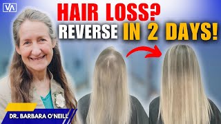 HAIR LOSS Mistakes Youre Making and How to Fix Them FAST [upl. by Dranel]