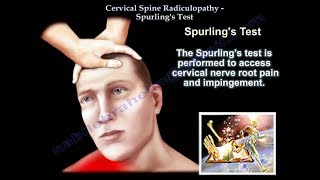 Cervical Spine Radiculopathy  Spurlings Test  Everything You Need To Know  Dr Nabil Ebraheim [upl. by Tower]