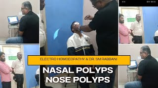 NASAL POLYPUS RUNNING NOSE ALLERGETIC RHINITIS OZEANA [upl. by Bolton530]