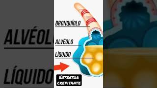 Estertor crepitante  Sonidos pulmonares [upl. by Euqinahc]