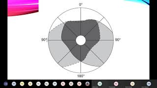 Physiology Perimetry amp Effect of Lision of Visual Pathway Mr Pandian [upl. by Entirb]