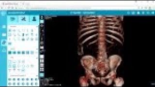 Viewing in 3D  postDICOM Free DICOM Viewer [upl. by Zahavi]