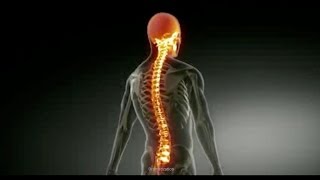 Paraplegic Info  What is Paraplegia [upl. by Euqirrne]