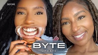 Fixing my TEETH Affordable Aligners to Straighten Teeth My Byte Journey Update  iamLindaElaine [upl. by Sandberg653]