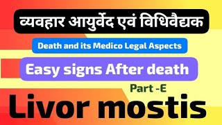 Livor mortis  Post mortem lividity  Early changes After death  sign of death  agadtantra [upl. by Anirbes591]