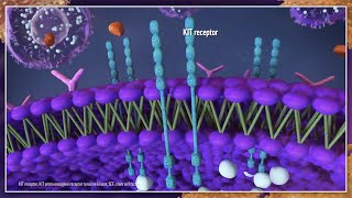 Is It Systemic Mastocytosis Best Practices for Diagnosis and Management [upl. by Oettam451]