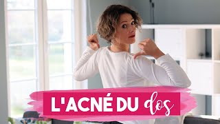 ACNE dans le DOS  5 CONSEILS pour vous en DEBARRASSER [upl. by Phillane]