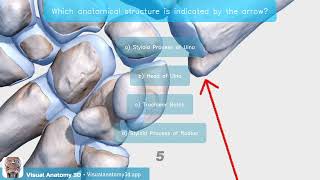 Anatomy Quiz Styloid Process of the Ulna [upl. by Eolande]