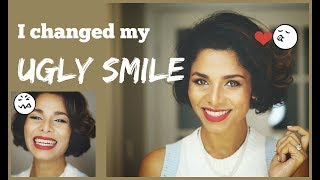 How to IMPROVE AWKWARD SMILE into PICTURE PERFECT Smile Without Dentist GIVEAWAY [upl. by Assena618]