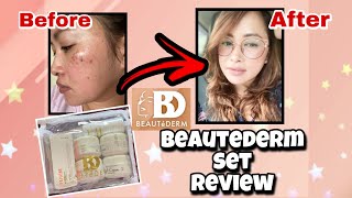 BEAUTEDERM Set Review  Beautederm Before and After  How to use Beautederm Set [upl. by Anirdnaxela]